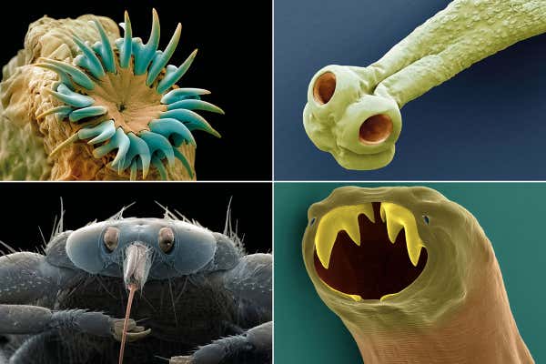 Why We Need Parasites